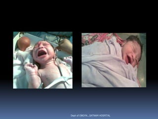 Dept of OBGYN...SATNAM HOSPITAL
 