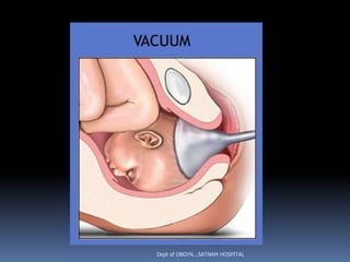 Dept of OBGYN...SATNAM HOSPITAL
 