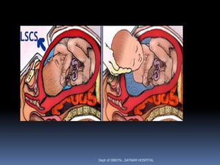 Dept of OBGYN...SATNAM HOSPITAL
 