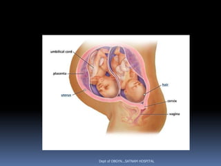 Dept of OBGYN...SATNAM HOSPITAL
 