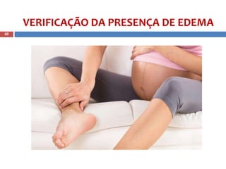 VERIFICAÇÃO DA PRESENÇA DE EDEMA
40
 