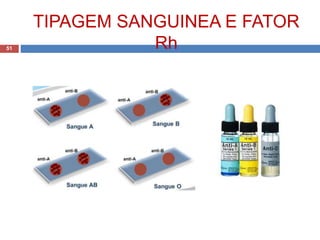 TIPAGEM SANGUINEA E FATOR
Rh51
 