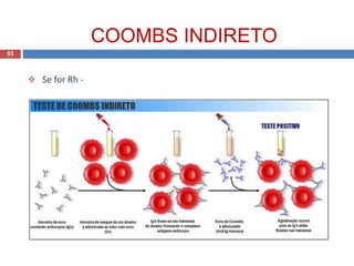 COOMBS INDIRETO
53
 Se for Rh -
 