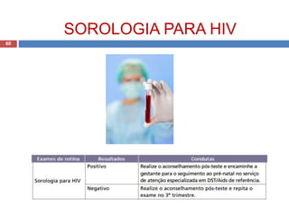 SOROLOGIA PARA HIV
60
 