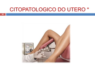 CITOPATOLOGICO DO UTERO *
65
 
