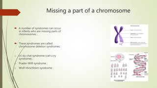 Missing a part of a chromosome
 A number of syndromes can occur
in infants who are missing parts of
chromosomes ;
 These syndromes are called
chromosome deletion syndromes :
o cri du chat syndrome (cat’s cry
syndrome) ;
o Prader-Willi syndrome ;
o Wolf-Hirschhorn syndrome ;
 