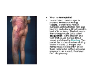 • What Is Hemophilia?
• Human blood contains special
proteins, known as clotting
factors. Identified by Roman
numerals, clotting factors help stop
bleeding and allow a blood vessel to
heal after an injury. The last step in
the clotting process (also called
coagulation) is the creation of a
"net" that closes the torn blood
vessel and stops the bleeding. This
part of the process involves clotting
factors VIII and IX. People with
hemophilia are deficient in one of
those factors due to their abnormal
genes and, as a result, their blood
can't clot properly.
 