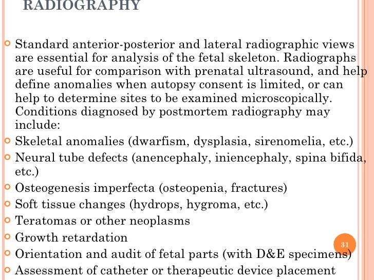 RADIOGRAPHY <ul><li>Standard anterior-posterior and lateral radiographic views are essential for analysis of the fetal ske...