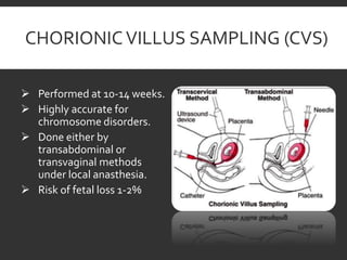 Prenatal diagnosis of down syndrome | PPTX
