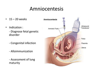 Amniocentesis
• 15 – 20 weeks
• Indication :
- Diagnose fetal genetic
disorder
- Congenital infection
- Alloimmunization
- Assessment of lung
maturity
 