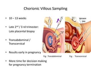 Chorionic Villous Sampling
• 10 – 13 weeks
• Late 2nd / 3 rd trimester:
Late placental biopsy
• Transabdominal /
Transcervical
• Results early in pregnancy
• More time for decision making
for pregnancy termination
Fig : Tranabdominal Fig : Transcervical
 