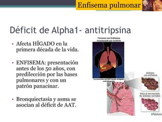Déficit de Alpha1- antitripsina
• Afecta HÍGADO en la
primera década de la vida.
• ENFISEMA: presentación
antes de los 50 ...