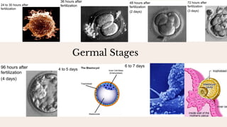 Germal Stages
 