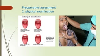 PRE OP pre operative assessment before surgery | PPTX