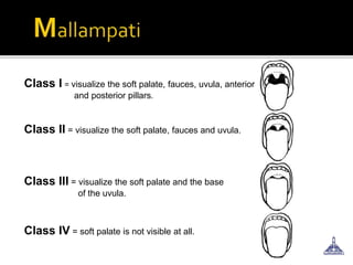 Class I = visualize the soft palate, fauces, uvula, anterior
and posterior pillars.
Class II = visualize the soft palate, fauces and uvula.
Class III = visualize the soft palate and the base
of the uvula.
Class IV = soft palate is not visible at all.
 