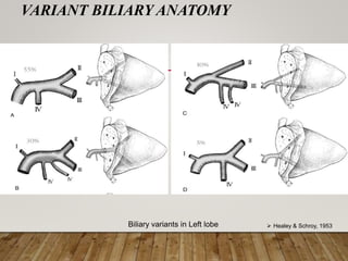 VARIANT BILIARY ANATOMY
Biliary variants in Left lobe  Healey & Schroy, 1953
 