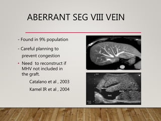 ABERRANT SEG VIII VEIN
- Found in 9% population
- Careful planning to
prevent congestion
• Need to reconstruct if
MHV not included in
the graft.
Catalano et al , 2003
Kamel IR et al , 2004
 