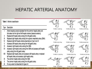 HEPATIC ARTERIAL ANATOMY
• Michel’s Classification of
branching pattern
• Type 1: Normal (75.7%)
• Type 2: Replaced or accessory LHA
from left gastric artery (9.7%)
• Type 3: Replaced or accessory RHA
from the SMA (10.6%)
• Type 4: Replaced or accessory LHA
plus replaced or accessory RHA (2.3%)
• Type 5: CHA from SMA (1.5%)
• Type 6: CHA from aorta (0.2%)
 