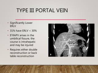 TYPE III PORTAL VEIN
• Significantly Lower
ERLV
• 31% have ERLV < 30%
• If RAPV arises in the
umbilical fissure, the
course is intrahepatic
and may be injured
• Requires either double
reconstruction or back
table reconstruction
 