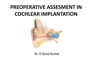 PREOPERATIVE ASSESMENT IN
COCHLEAR IMPLANTATION
Dr. D.Sunil Kumar
 
