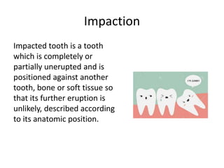 Simple Tooth Impaction Preoperative assesment in minor oral surgery | PPTX