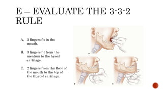 Preoperative Assessment, Preparation, Premedication.pptx