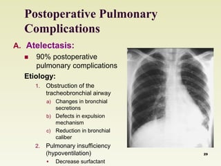 Postoperative Pulmonary 
Complications 
A. Atelectasis: 
 90% postoperative 
pulmonary complications 
Etiology: 
1. Obstruction of the 
tracheobronchial airway 
a) Changes in bronchial 
secretions 
b) Defects in expulsion 
mechanism 
c) Reduction in bronchial 
caliber 
2. Pulmonary insufficiency 
(hypoventilation) 
 Decrease surfactant 
29 
 