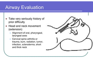 Airway EvaluationTake very seriously history of prior difficultyHead and neck movement (extension)Alignment of oral, pharyngeal, laryngeal axesCervical spine arthritis or trauma, burn, radiation, tumor, infection, scleroderma, short and thick neck