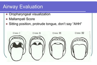 Airway EvaluationOropharyngeal visualizationMallampati ScoreSitting position, protrude tongue, don’t say “AHH”
