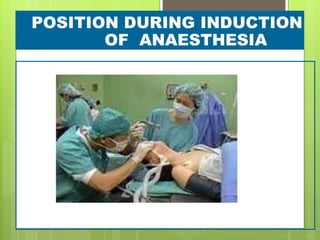 POSITION DURING INDUCTION
OF ANAESTHESIA
 