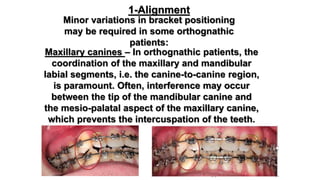 Preoperative orthodontics for orthognathic surgery | PPTX