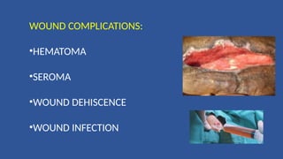 WOUND COMPLICATIONS:
•HEMATOMA
•SEROMA
•WOUND DEHISCENCE
•WOUND INFECTION
 