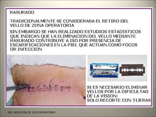 Dr. Eugenio Vargas Carbajal 
ISO: INFECCION DE SITIO OPERATORIO 35 
CMP 11161 - RNE 4368 
 