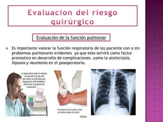 Evaluación de la función pulmonar

   Es importante valorar la función respiratoria de los paciente con o sin
    problemas pulmonares evidentes ya que esto servirá como factor
    pronostico en desarrollo de complicaciones ,como la atelectasia,
    hipoxia y neumonía en el posoperatorio.
 