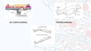 DE CUBITO DORSAL TRENDELENBURG
 