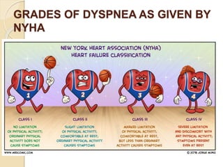 GRADES OF DYSPNEA AS GIVEN BY
NYHA
 