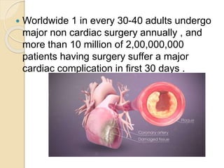  Worldwide 1 in every 30-40 adults undergo
major non cardiac surgery annually , and
more than 10 million of 2,00,000,000
...
