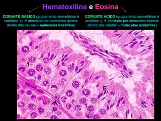 Hematoxilina e Eosina
CORANTE BÁSICO (grupamento cromofórico é
catiônico +)  afinidade por elementos ácidos
dentro das células – moléculas basófilas)
CORANTE ÁCIDO (grupamento cromofórico é
aniônico -)  afinidade por elementos básicos
dentro das células – moléculas acidófilas)
 