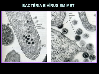 BACTÉRIA E VÍRUS EM MET
 