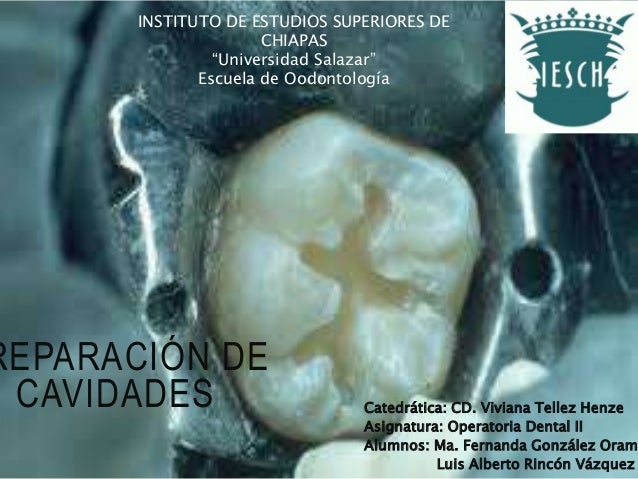 Preparación de cavidades operatoria