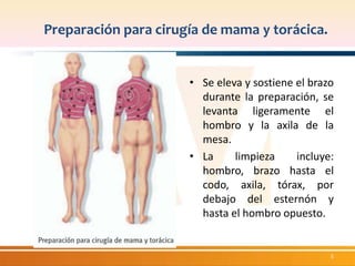 Preparación para cirugía de mama y torácica. 
• Se eleva y sostiene el brazo 
durante la preparación, se 
levanta ligeramente el 
hombro y la axila de la 
mesa. 
• La limpieza incluye: 
hombro, brazo hasta el 
codo, axila, tórax, por 
debajo del esternón y 
hasta el hombro opuesto. 
5 
 