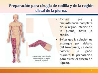 Preparación para cirugía de rodilla y de la región 
distal de la pierna. 
• Incluye pie y 
circunferencia completa 
de la región inferior de 
la pierna, hasta la 
rodilla. 
• Evitar que la solución es 
estanque por debajo 
del torniquete, se debe 
colocar un paño 
durante la preparación 
para evitar el exceso de 
líquido. 
6 
 