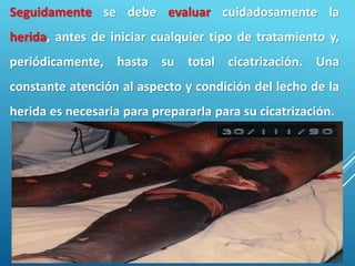 11
Seguidamente se debe evaluar cuidadosamente la
herida, antes de iniciar cualquier tipo de tratamiento y,
periódicamente, hasta su total cicatrización. Una
constante atención al aspecto y condición del lecho de la
herida es necesaria para prepararla para su cicatrización.
 