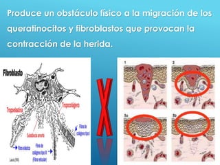 37
Produce un obstáculo físico a la migración de los
queratinocitos y fibroblastos que provocan la
contracción de la herida.
 
