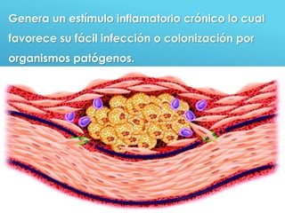 38
Genera un estímulo inflamatorio crónico lo cual
favorece su fácil infección o colonización por
organismos patógenos.
 