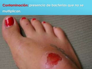 55
Contaminación: presencia de bacterias que no se
multiplican.
 