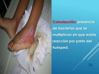 56
Colonización: presencia
de bacterias que se
multiplican sin que exista
reacción por parte del
huésped.
 