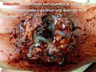 58
Infección: las bacterias han invadido el tejido, se
están multiplicando y generan una reacción en el
huésped.
 
