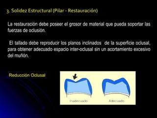 Preparación dental | PPT