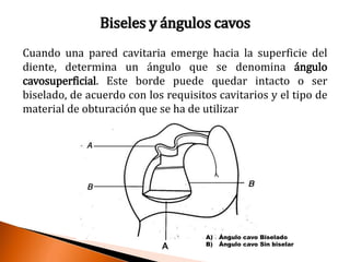 Biseles y ángulos cavos 
Cuando una pared cavitaria emerge hacia la superficie del 
diente, determina un ángulo que se denomina ángulo 
cavosuperficial. Este borde puede quedar intacto o ser 
biselado, de acuerdo con los requisitos cavitarios y el tipo de 
material de obturación que se ha de utilizar 
A 
A) Ángulo cavo Biselado 
B) Ángulo cavo Sin biselar 
 